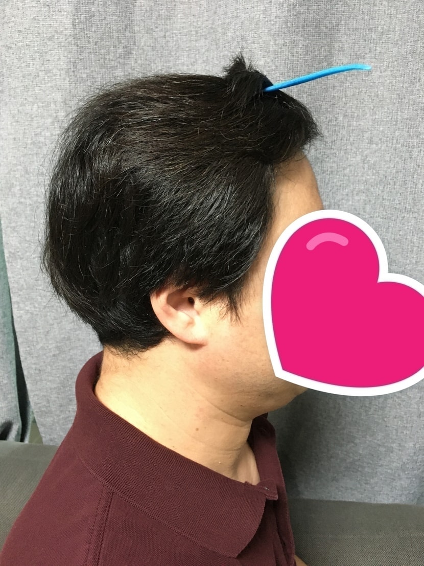 6개월차