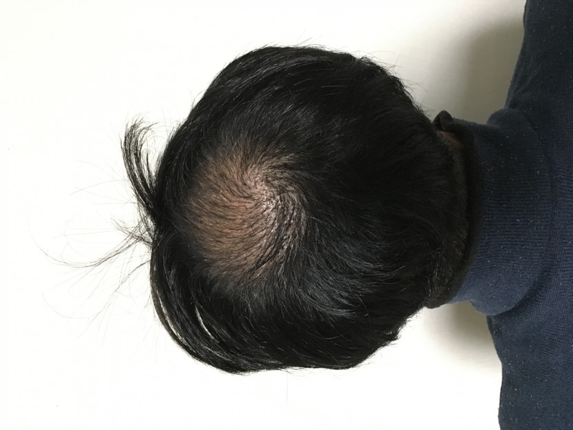 7일차