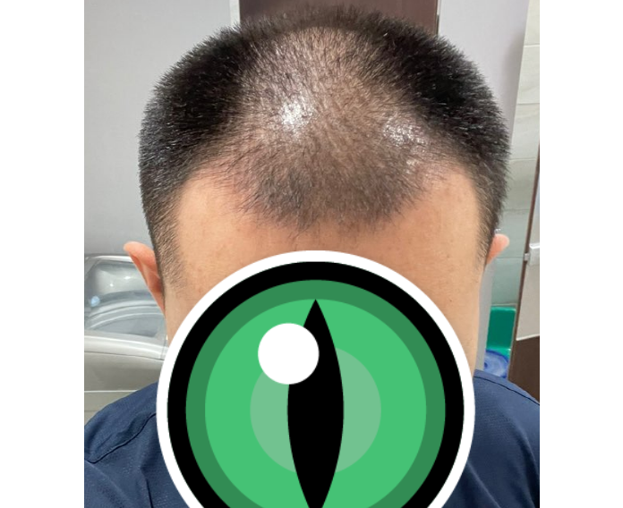 전 1.PNG