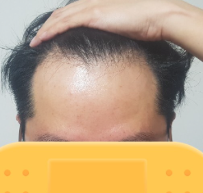 1.PNG