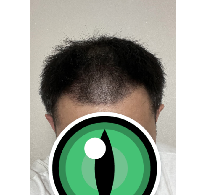 후 2.PNG