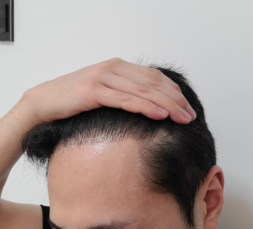 6개월차