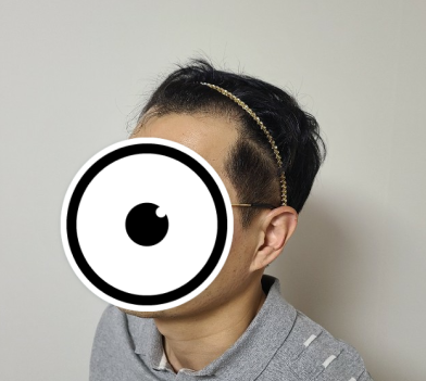 박천선 수술 전 3.PNG