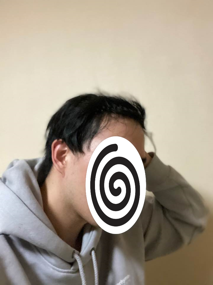 후 3.png