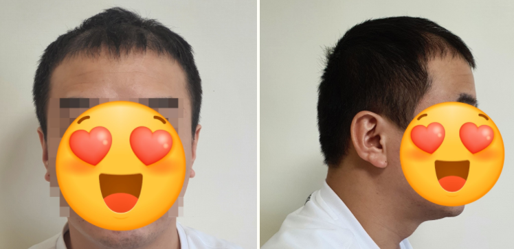 수술 후 1.PNG