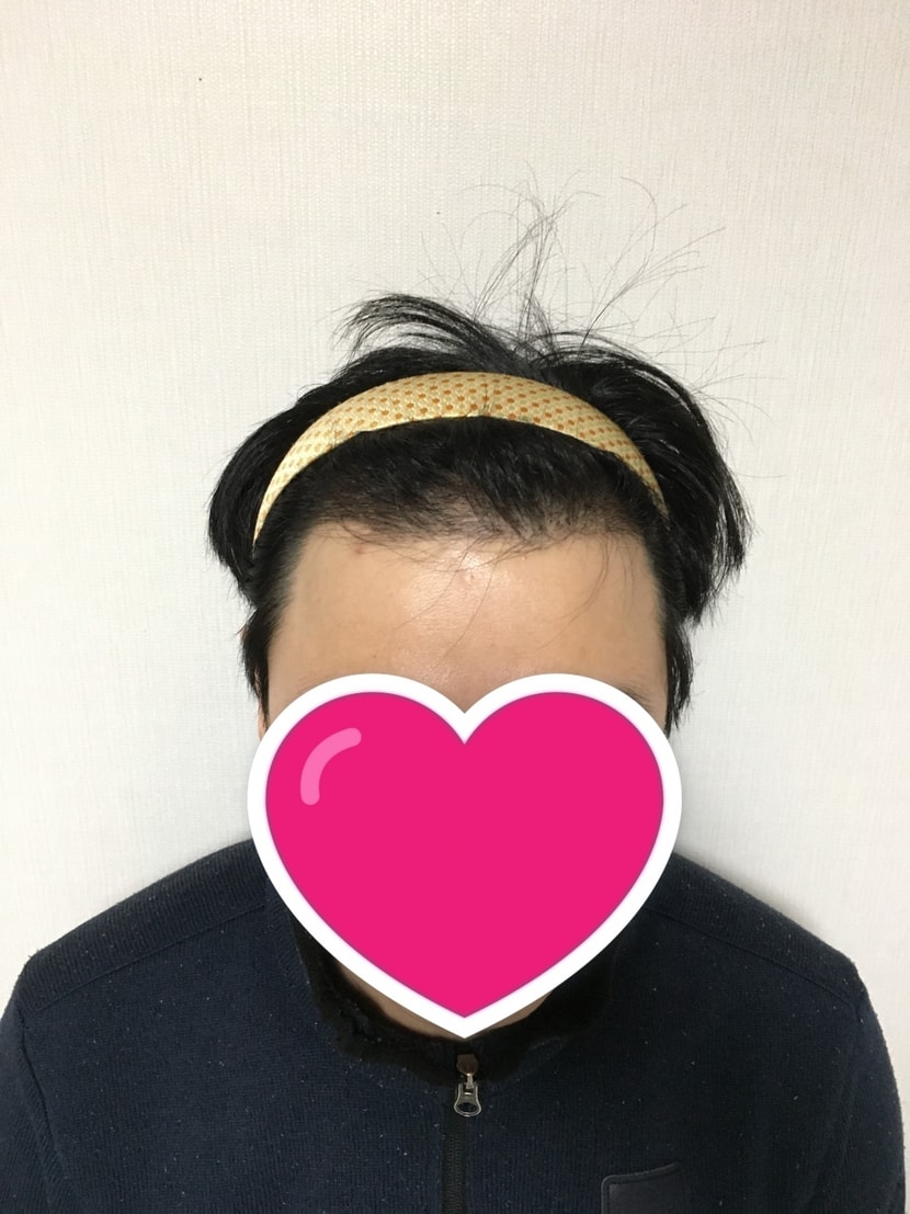 7일차