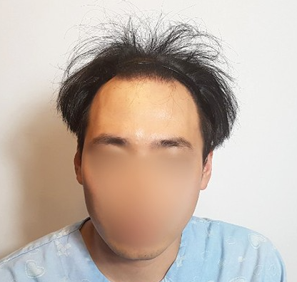 김길용 수술 전 2.PNG