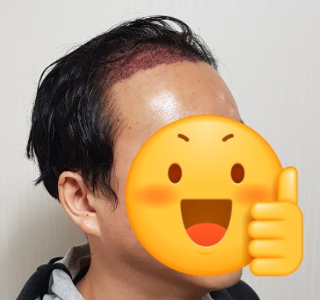 김대성 수술 1일차 3.PNG