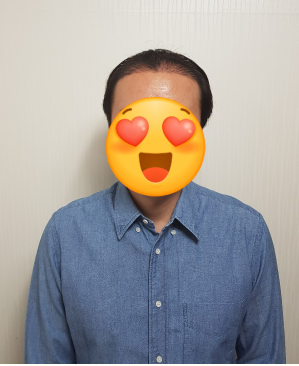 김대성 수술 14일 2.PNG
