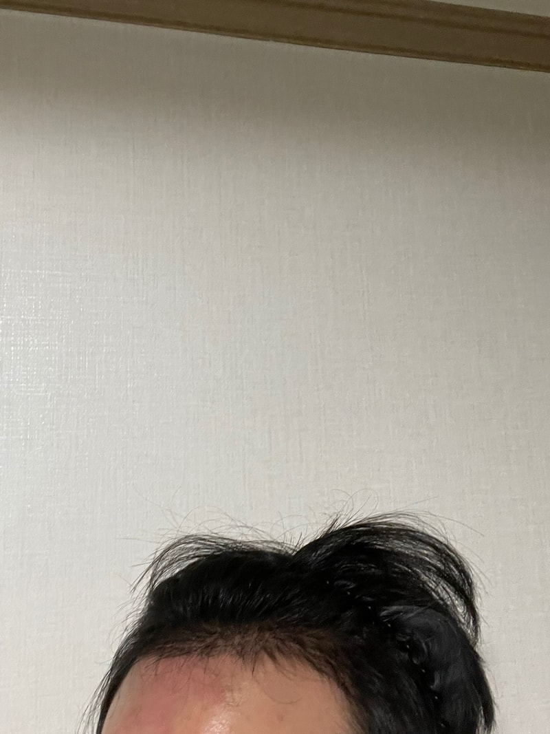 후 3.jpg