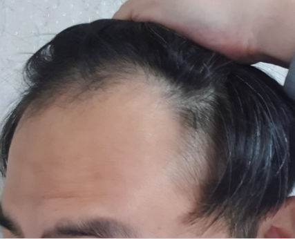 전입니다