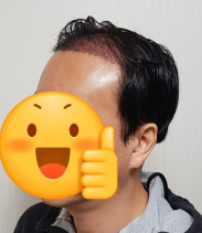 김대성 수술 1일차 2.PNG