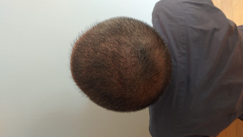 후4.jpg