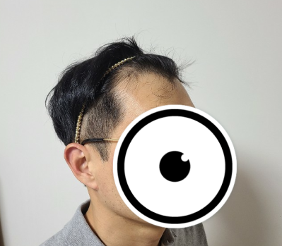 박천선 수술 전 2.PNG