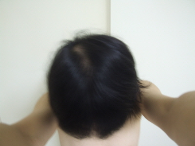 크기변환_가르마탄후 수리.JPG