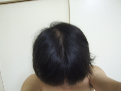 크기변환_가르마탄후 윗머리.JPG