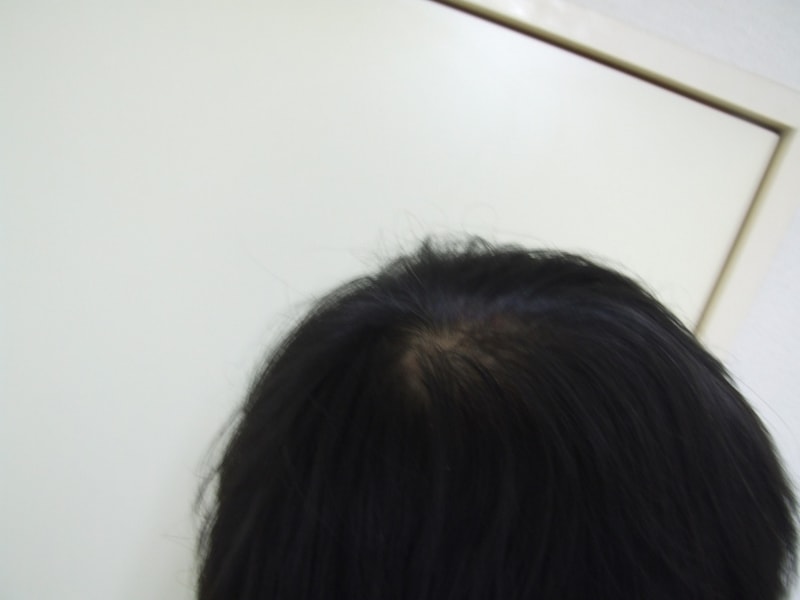 오른쪽.jpg