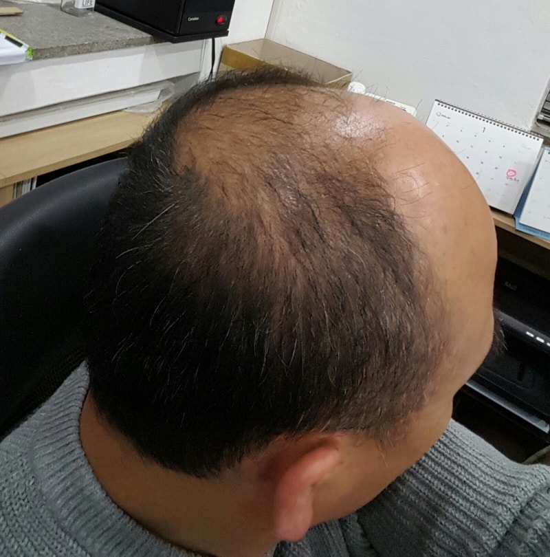 옆머리 뒷머리 사진.jpg