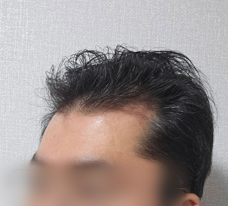 공식카페-후기-사용보정X-3_1.jpg