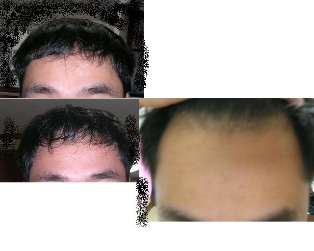 z.JPG