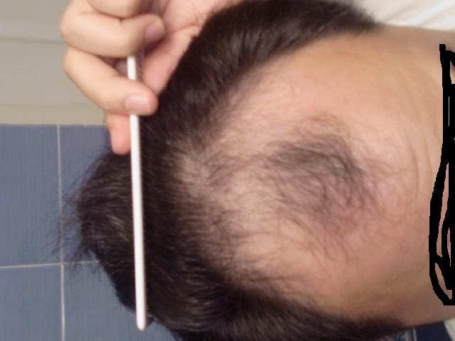 3.올백.jpg