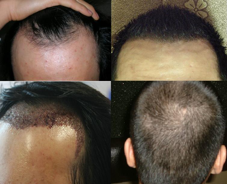 6 months0.JPG