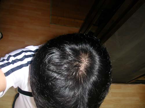 mrb1002472_a.jpg