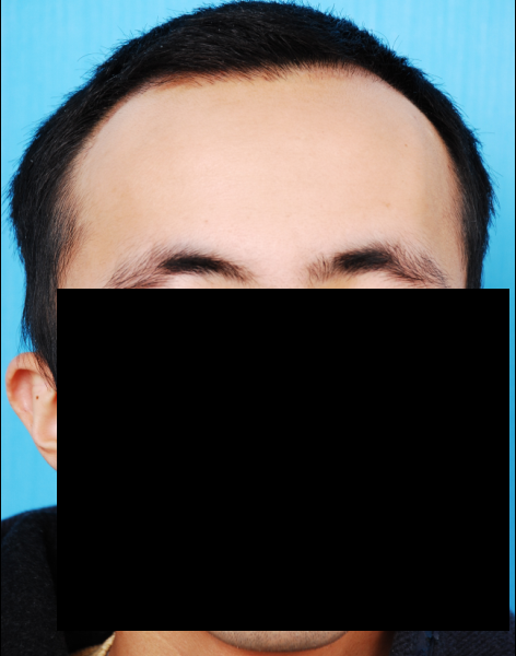 정면1.bmp