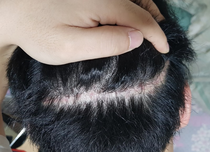 KakaoTalk_20180321_102700051.jpg