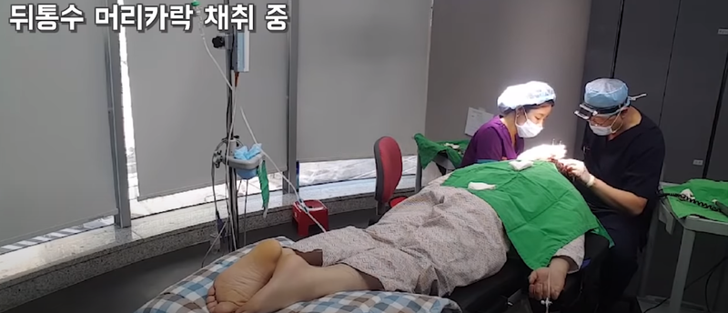 모BJ수술사진.png