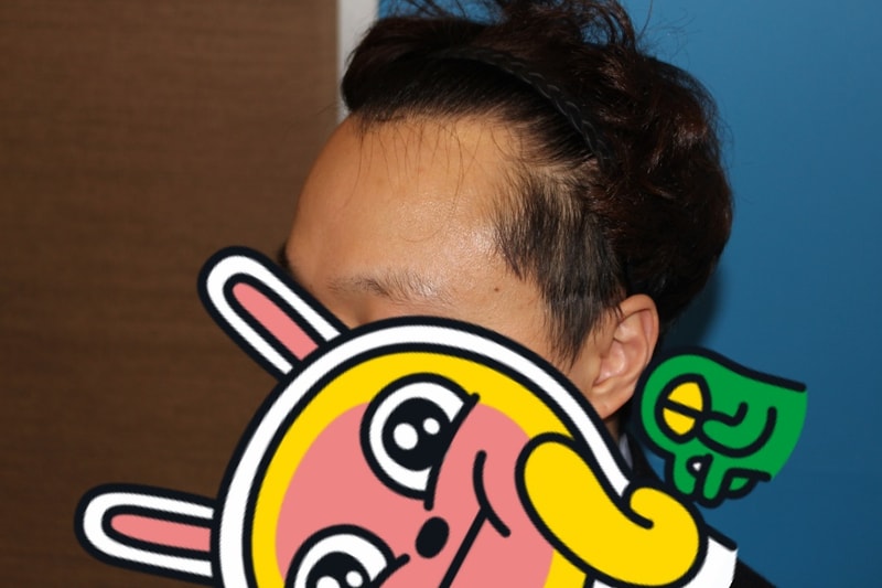 좌측.jpg
