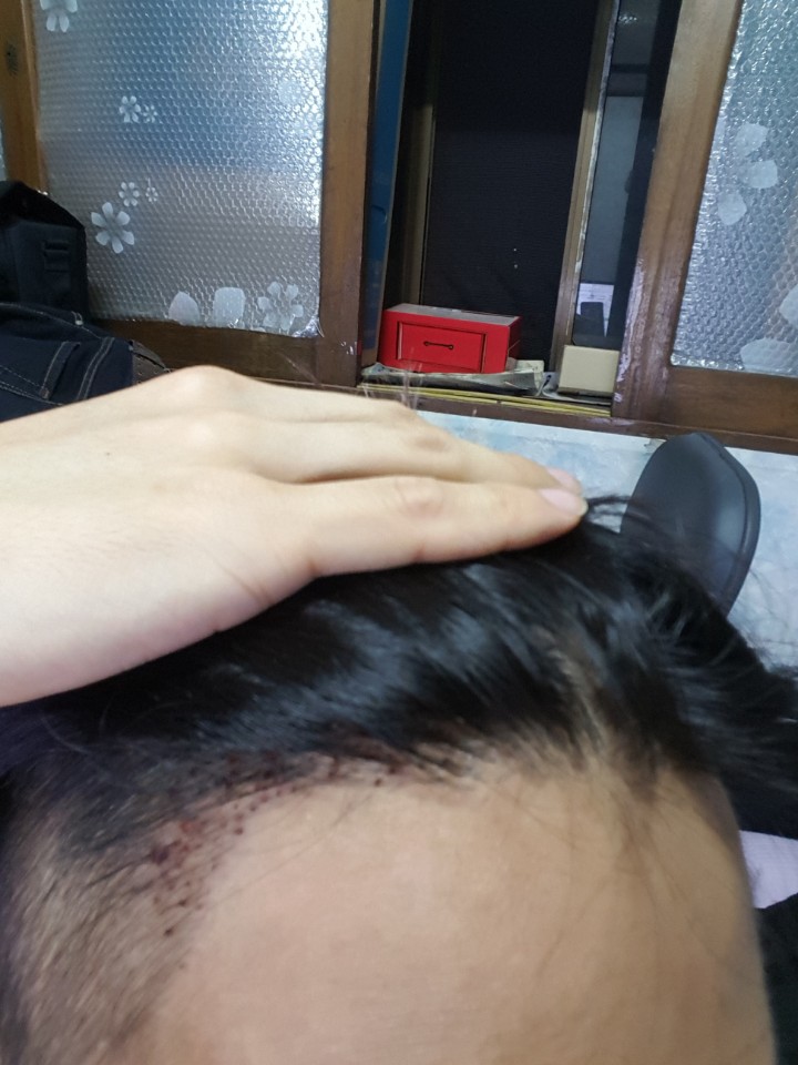 KakaoTalk_20170704_011900047.jpg