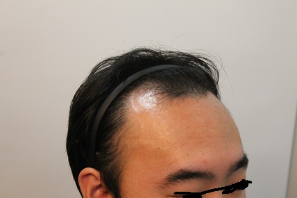 수술전 (4).JPG
