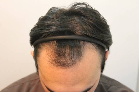 수술전 (1).JPG