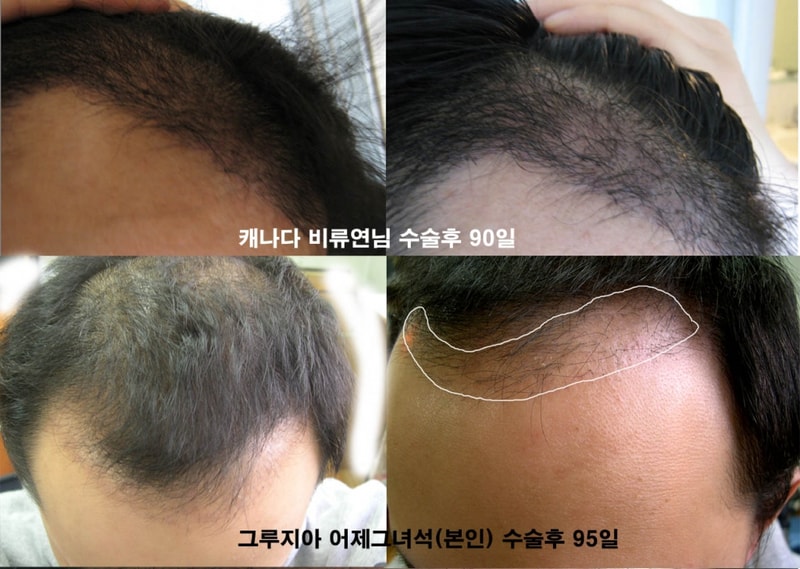 캐나다vs그루지아2.jpg