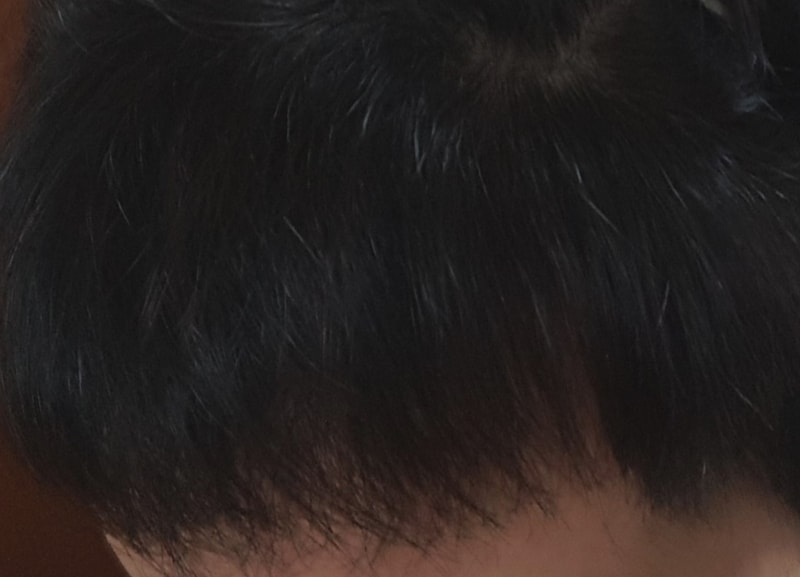 왼쪽 2.jpg