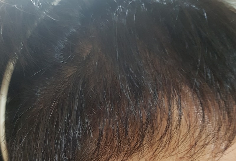 오른쪽 1.jpg