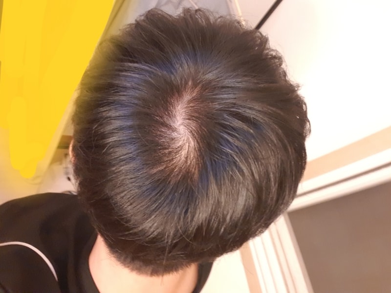 20180712_000914.jpg
