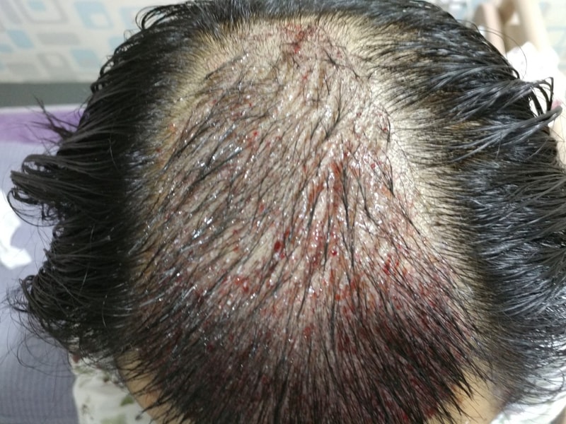 수술후.jpg