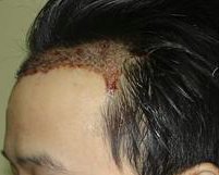 after OP3-1.jpg