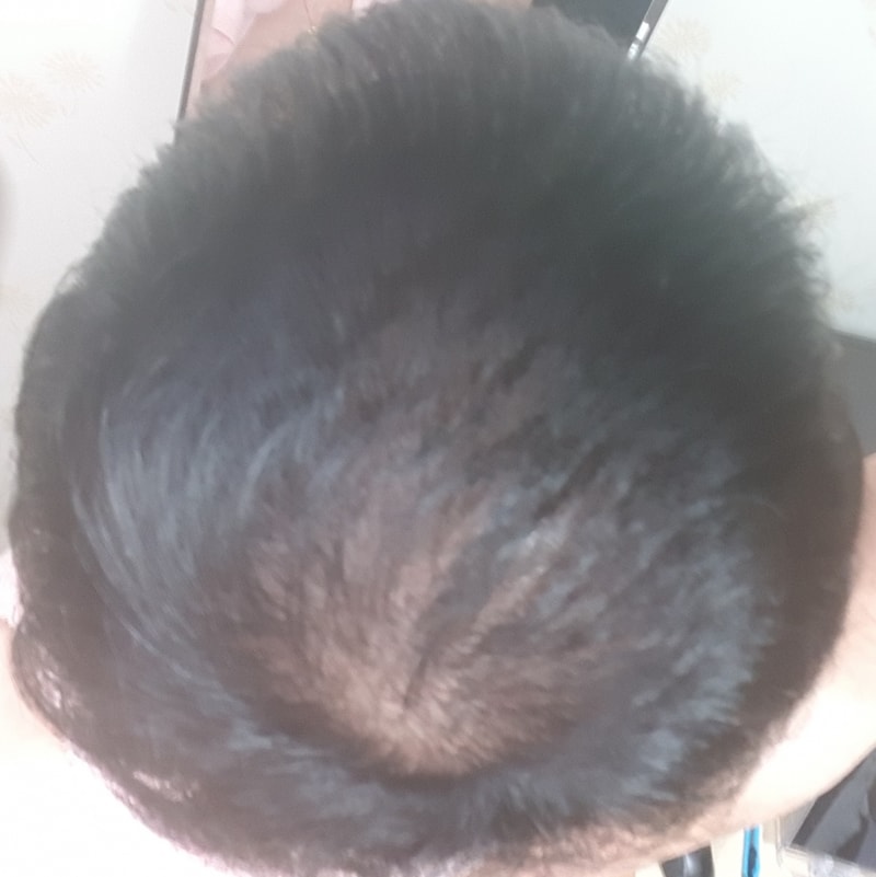 20181115_004837.jpg