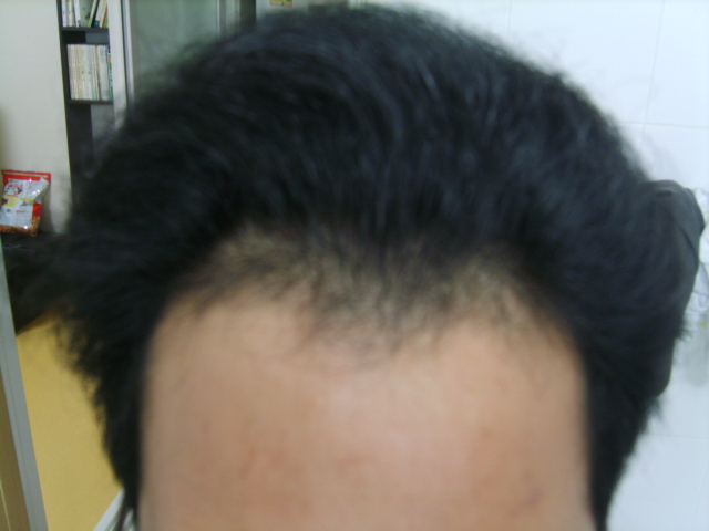 XL802380.JPG