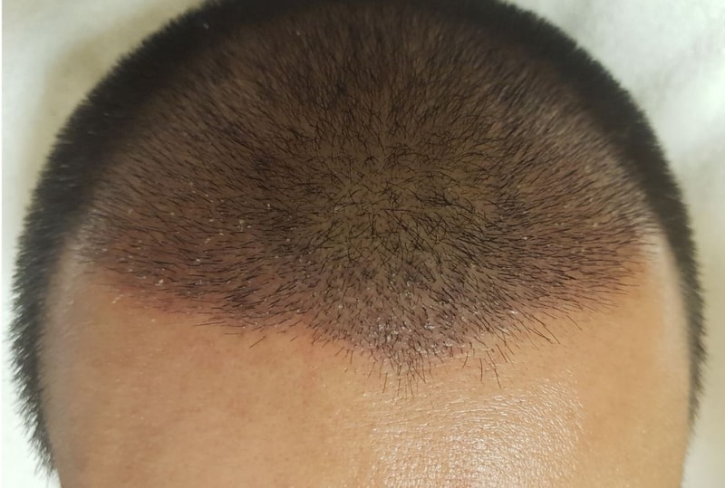 asassssss.JPG