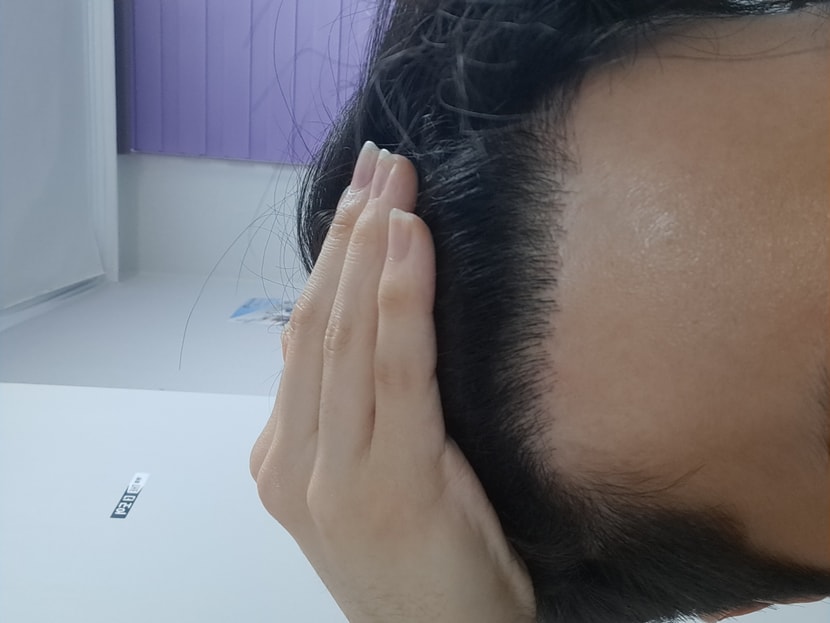왼쪽