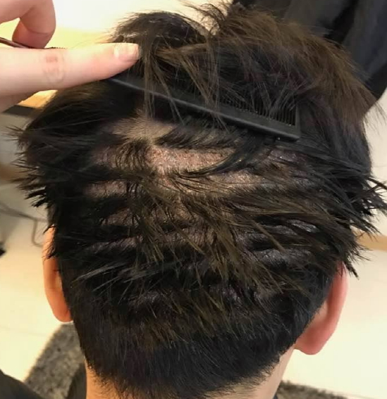 샴푸후 뒷머리 상태.jpg