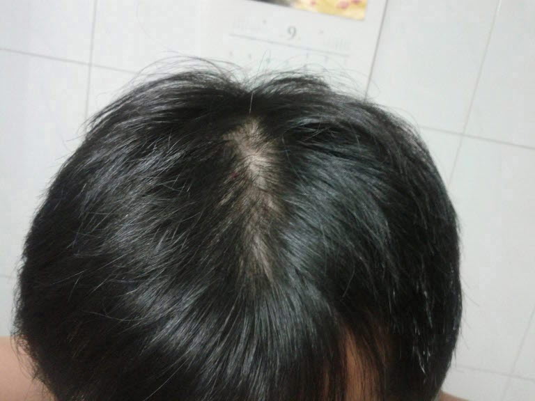 윗머리.jpg