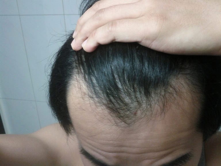 앞이마2.jpg