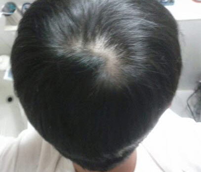 정수리.jpg
