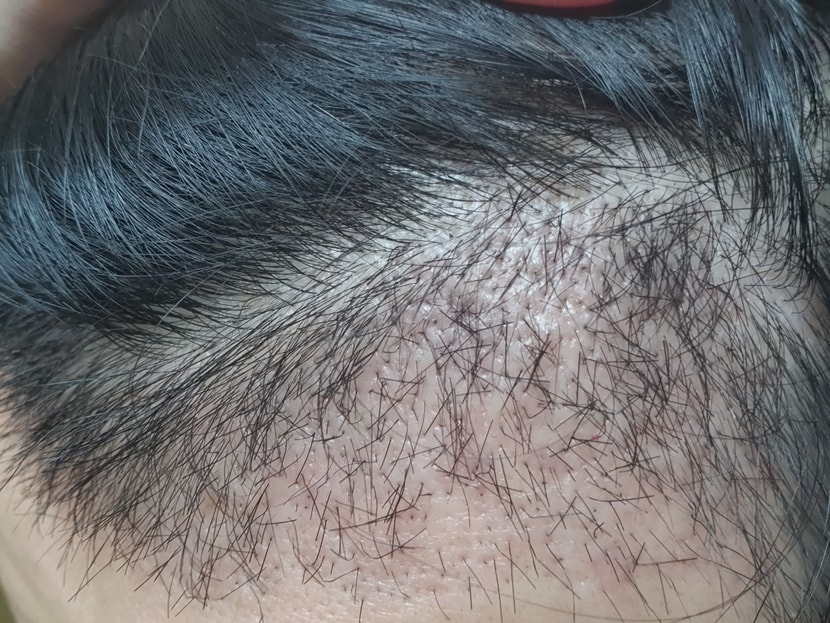 26일차