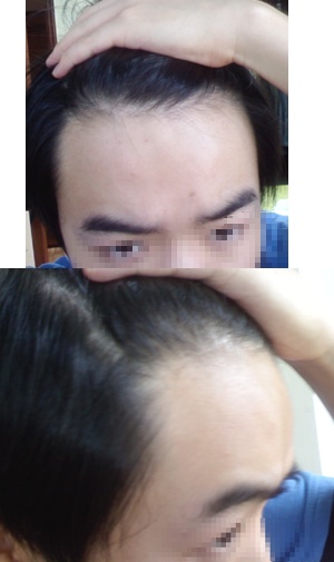 ff.jpg